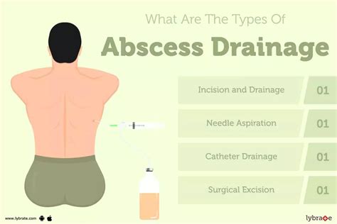 abscess antonyms